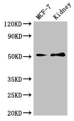 Western Blot Positive WB detected in: MCF-7 whole cell lysate, Mouse kidney tissue All lanes: GFRA1 antibody at 3µg/ml Secondary Goat polyclonal to rabbit IgG at 1/50000 dilution Predicted band size: 52, 51 kDa Observed band size: 52 kDa