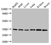 Western Blot Positive WB detected in: HepG2 whole cell lysate, A549 whole cell lysate, Mouse liver tissue, Mouse lung tissue, Mouse kidney tissue, Mouse brain tissue All lanes: GFRA2 antibody at 3.5ug/ml Secondary Goat polyclonal to rabbit IgG at...