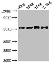 Western Blot Positive WB detected in Recombinant protein All lanes: Gamma-glutamy antibody at 2.7ug/ml Secondary Goat polyclonal to rabbit IgG at 1/50000 dilution predicted band size: 52 kDa observed band size: 52 kDa