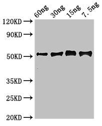 Western Blot Positive WB detected in Recombinant protein All lanes: Gamma-glutamy antibody at 2.7ug/ml Secondary Goat polyclonal to rabbit IgG at 1/50000 dilution predicted band size: 52 kDa observed band size: 52 kDa