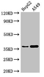 Western Blot Positive WB detected in: HepG2 whole cell lysate, A549 whole cell lysate All lanes: GGH antibody at 3µg/ml Secondary Goat polyclonal to rabbit IgG at 1/50000 dilution Predicted band size: 36 kDa Observed band size: 36 kDa