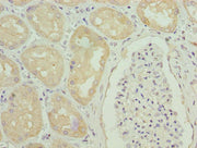 Immunohistochemistry of paraffin-embedded human kidney tissue using CSB-PA009404LA01HU at dilution of 1:100
