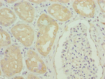 Immunohistochemistry of paraffin-embedded human kidney tissue using CSB-PA009404LA01HU at dilution of 1:100
