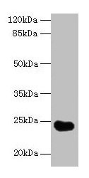 Western blot All lanes: GGTLC2 antibody at 2µg/ml + Mouse kidney tissue Secondary Goat polyclonal to rabbit IgG at 1/10000 dilution Predicted band size: 24 kDa Observed band size: 24 kDa