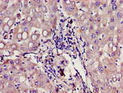 Immunohistochemistry of paraffin-embedded human liver tissue using CSB-PA009411LA01HU at dilution of 1:100