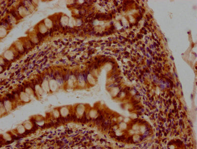 IHC image of CSB-PA009434PA01HU diluted at 1:400 and staining in paraffin-embedded human small intestine tissue performed on a Leica BondTM system. After dewaxing and hydration, antigen retrieval was mediated by high pressure in a citrate buffer (...
