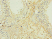 Secondary antibody only control: uses 1% BSA instead of primary antibody