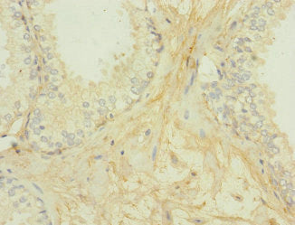 Secondary antibody only control: uses 1% BSA instead of primary antibody