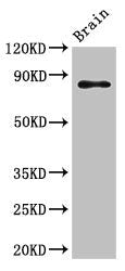 Western Blot Positive WB detected in: Mouse brain tissue All lanes: GIT1 antibody at 3.5ug/ml Secondary Goat polyclonal to rabbit IgG at 1/50000 dilution Predicted band size: 85, 20, 86 kDa Observed band size: 85 kDa