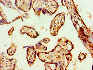 Immunohistochemistry of paraffin-embedded human placenta tissue using CSB-PA009443ESR1HU at dilution of 1:100