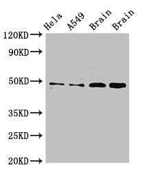 Western Blot Positive WB detected in: Hela whole cell lysate, A549 whole cell lysate, Rat brain tissue, Mouse brain tissue All lanes: GJA8 antibody at 2.5ug/ml Secondary Goat polyclonal to rabbit IgG at 1/50000 dilution Predicted band size: 49 kDa...