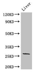 Western Blot Positive WB detected in: Mouse liver tissue All lanes: GJB2 antibody at 3ug/ml Secondary Goat polyclonal to rabbit IgG at 1/50000 dilution Predicted band size: 27 kDa Observed band size: 27 kDa