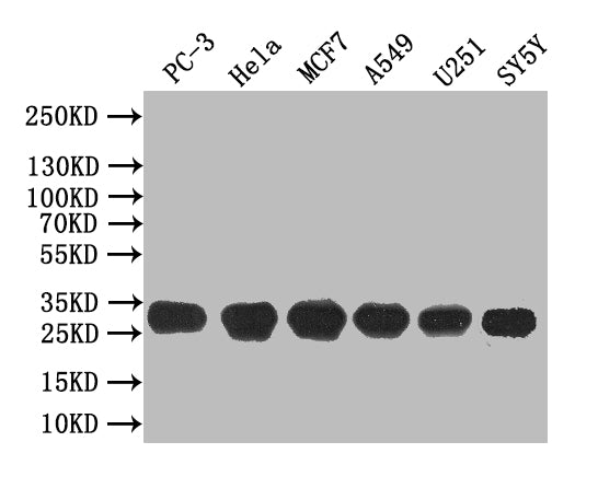 Western Blot Positive WB detected in: PC-3 whole cell lysate, Hela whole cell lysate, MCF7 whole cell lysate, A549 whole cell lysate, U251 whole cell lysate, SY5Y whole cell lysate All lanes: GJB3 antibody at 1:1000 Secondary Goat polyclonal to ra...