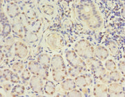 Goat polyclonal to rabbit IgG at 1/50000 dilution