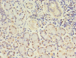 Goat polyclonal to rabbit IgG at 1/50000 dilution
