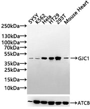 Western Blot Positive WB detected in: SY5Y whole cell lysate(30µg), K562 whole cell lysate(30µg), Hela whole cell lysate(30µg), HT29 whole cell lysate(30µg),293T whole cell lysate(30µg),Mouse Heart tissue lysate30µg) All lanes: GJC1 antibody at 1:...
