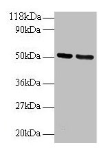 Western blot All lanes: GDI2 antibody at 2µg/ml Lane 1: 293T whole cell lysate Lane 2: EC109 whole cell lysate Secondary Goat polyclonal to rabbit IgG at 1/15000 dilution Predicted band size: 51, 46 kDa Observed band size: 51 kDa