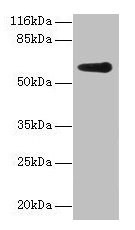 Western blot All lanes: GK2 antibody at 2µg/ml + Jurkat whole cell lysate Secondary Goat polyclonal to rabbit IgG at 1/10000 dilution Predicted band size: 61 kDa Observed band size: 61 kDa
