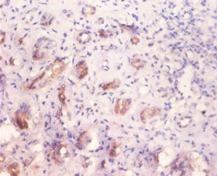 Immunohistochemistry of paraffin embedded human kidney tissue using CSB-PA009474LA01HU at dilution of 1:100