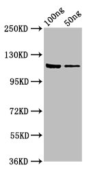 Western Blot Positive WB detected in: Recombinant protein All lanes: lacZ antibody at 7.5ug/ml Secondary Goat polyclonal to rabbit IgG at 1/50000 dilution Predicted band size: 117 kDa Observed band size: 117 kDa