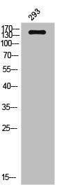 Western Blot analysis of 293 cells using IGF-IR Polyclonal Antibody