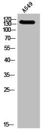 Western Blot analysis of A549 cells using IGF-IR Polyclonal Antibody