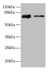 Western blot All lanes: GLCE antibody at 12µg/ml Lane 1: Rat liver tissue Lane 2: Mouse kidney tissue Secondary Goat polyclonal to rabbit IgG at 1/10000 dilution Predicted band size: 71 kDa Observed band size: 71 kDa