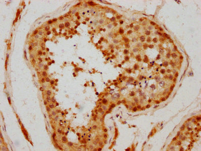 IHC image of CSB-PA009502LA01HU diluted at 1:300 and staining in paraffin-embedded human testis tissue performed on a Leica BondTM system. After dewaxing and hydration, antigen retrieval was mediated by high pressure in a citrate buffer (pH 6.0)....