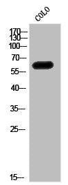 Western Blot analysis of CoLo cells using ALS Polyclonal Antibody