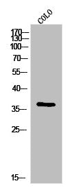 Western Blot analysis of colo cells using IgG1 Polyclonal Antibody