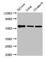 Western Blot Positive WB detected in: Mouse spleen tissue, Mouse lung tissue, Mouse stomach tissue All lanes: Glp1r antibody at 3µg/ml Secondary Goat polyclonal to rabbit IgG at 1/50000 dilution Predicted band size: 54 kDa Observed band size: 54 kDa