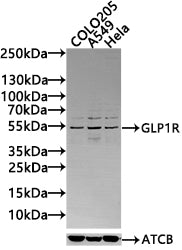 Western blot All lanes: GLP1R antibody at 2µg/ml + 293T whole cell lysate Secondary Goat polyclonal to rabbit IgG at 1/10000 dilution Predicted band size: 54 kDa Observed band size: 54 kDa