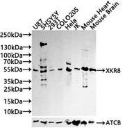 Western blot All lanes: GLP1R antibody at 12µg/ml Lane 1: Mouse heart tissue Lane 2: 293T whole cell lysate Secondary Goat polyclonal to rabbit IgG at 1/10000 dilution Predicted band size: 54 kDa Observed band size: 54 kDa
