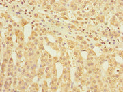 Immunohistochemistry of paraffin-embedded human adrenal gland tissue using CSB-PA009515ESR2HU at dilution of 1:100