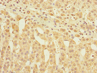 Immunohistochemistry of paraffin-embedded human adrenal gland tissue using CSB-PA009515ESR2HU at dilution of 1:100