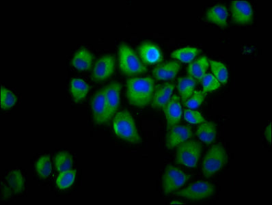 Immunofluorescence staining of Hela cells with CSB-PA009520LA01HU at 1:200, counter-stained with DAPI. The cells were fixed in 4% formaldehyde, permeabilized using 0.2% Triton X-100 and blocked in 10% normal Goat Serum. The cells were then incubat...