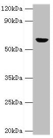Western blot All lanes: GLUD2 antibody at 2µg/ml + 293T whole cell lysate Secondary Goat polyclonal to rabbit IgG at 1/10000 dilution Predicted band size: 61 kDa Observed band size: 61 kDa
