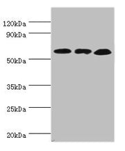 Western blot All lanes: Glutamate dehydrogenase 2, mitochondrial antibody at 4ug/ml Lane 1: Mouse brain tissue Lane 2: 293T whole cell lysate Lane 3: Rat brain tissue Secondary Goat polyclonal to rabbit IgG at 1/10000 dilution Predicted band size:...