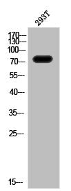 Western Blot analysis of 293T cells using Phospho-IL-2Rβ (Y364) Polyclonal Antibody