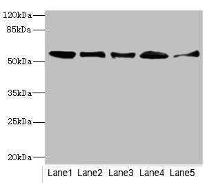 Western blot All lanes: GLYCTKantibody at 5.43ug/ml Lane 1: Mouse liver tissue Lane 2: Mouse lung tissue Lane 3: Mouse kidney tissue Lane 4: Rat lung tissue Lane 5: NIH/3T3 whole cell lysate Secondary Goat polyclonal to rabbit IgG at 1/10000 dilut...