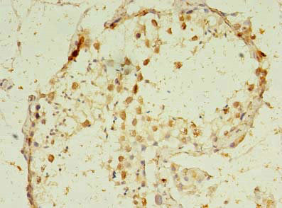 Immunohistochemistry of paraffin-embedded human testis tissue using CSB-PA009577LA01HU at dilution of 1:100