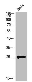 Western Blot analysis of HeLa cells using IL-12A Polyclonal Antibody