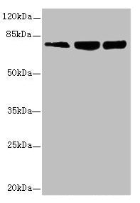 Western blot All lanes: GMPS antibody at 2.69µg/ml Lane 1: Hela whole cell lysate Lane 2: HL60 whole cell lysate Lane 3: MCF-7 whole cell lysate Secondary Goat polyclonal to Rabbit IgG at 1/10000 dilution Predicted band size: 77, 66 kDa Observed b...