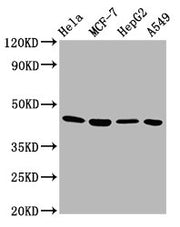 Western Blot Positive WB detected in: Hela whole cell lysate, MCF-7 whole cell lysate, HepG2 whole cell lysate, A549 whole cell lysate All lanes: GNA12 antibody at 5.8µg/ml Secondary Goat polyclonal to rabbit IgG at 1/50000 dilution Predicted band...