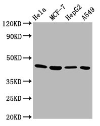 Western Blot Positive WB detected in: Hela whole cell lysate, MCF-7 whole cell lysate, HepG2 whole cell lysate, A549 whole cell lysate All lanes: GNA12 antibody at 5.8µg/ml Secondary Goat polyclonal to rabbit IgG at 1/50000 dilution Predicted band...