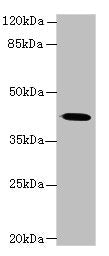 Western blot All lanes: GNA14 antibody at 3µg/ml + Mouse lung tissue Secondary Goat polyclonal to rabbit IgG at 1/10000 dilution Predicted band size: 42 kDa Observed band size: 42 kDa