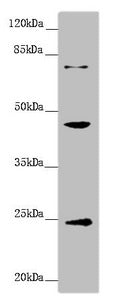 Western blot All lanes: GNA15 antibody at 1.41 ug/ml + Mouse liver tissue Secondary Goat polyclonal to rabbit IgG at 1/10000 dilution Predicted band size: 44 kDa Observed band size: 44, 24, 72 kDa