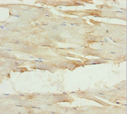 Immunohistochemistry of paraffin-embedded human skeletal muscle tissue using CSB-PA009587ESR2HU at dilution of 1:100