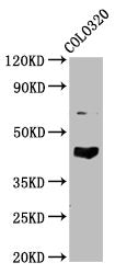 Western Blot Positive WB detected in: Colo320 whole cell lysate All lanes: GNAL antibody at 4.8µg/ml Secondary Goat polyclonal to rabbit IgG at 1/50000 dilution Predicted band size: 45, 53, 21 kDa Observed band size: 45 kDa