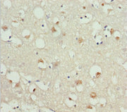 Immunohistochemistry of paraffin-embedded human brain tissue using CSB-PA009593DSR2HU at dilution of 1:100